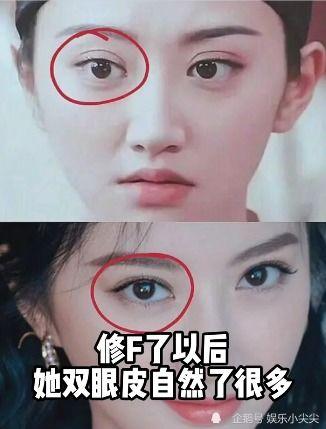 明星网红整容现状,美丽背后的代价与反思
